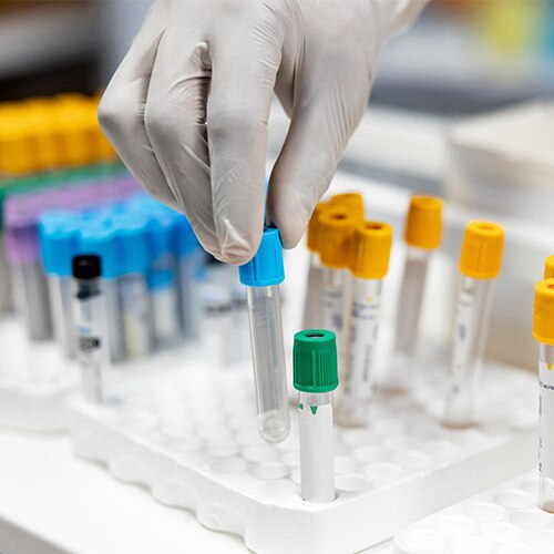 How to delete your 23andMe data (and why you should)
